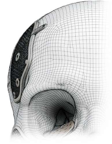 Cranial implant upper left