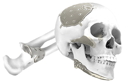 Titanium Implants