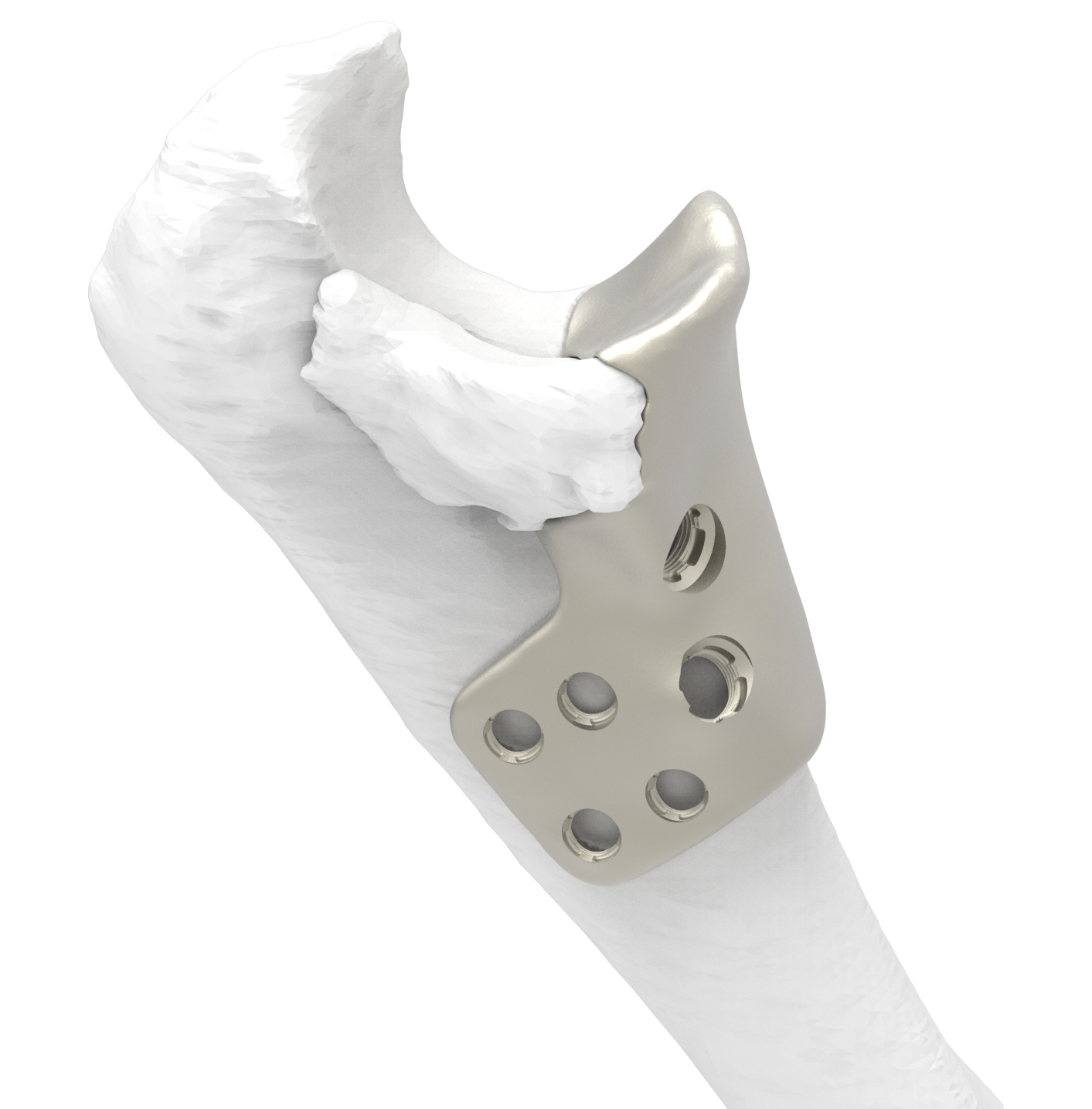 PRIMARY-OBPU detail 2