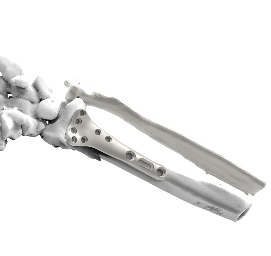 PRIMARY-OBPU detail 3